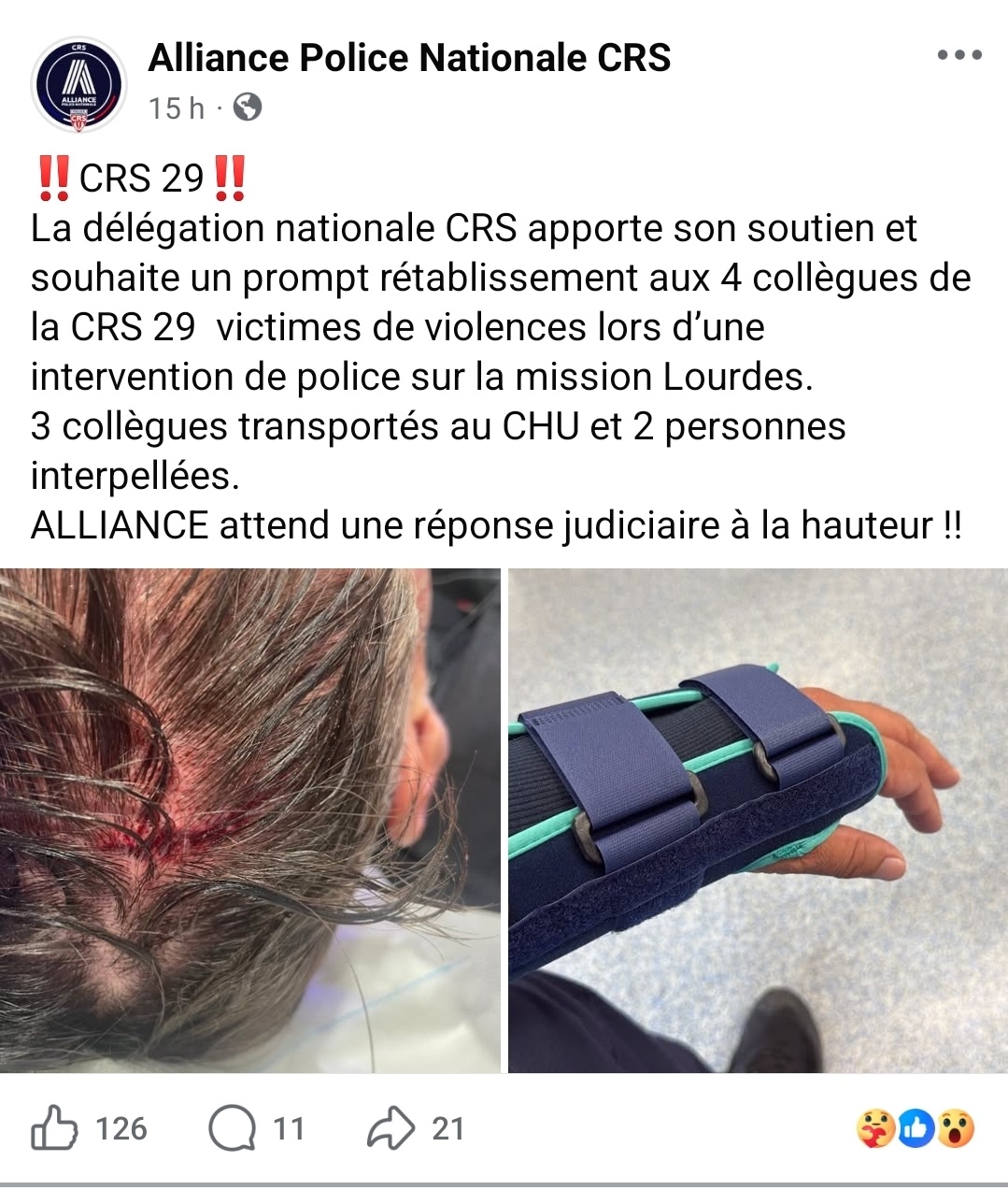 Lourdes : quatre CRS blessés place Marcadal, le syndicat Alliance publie les photos